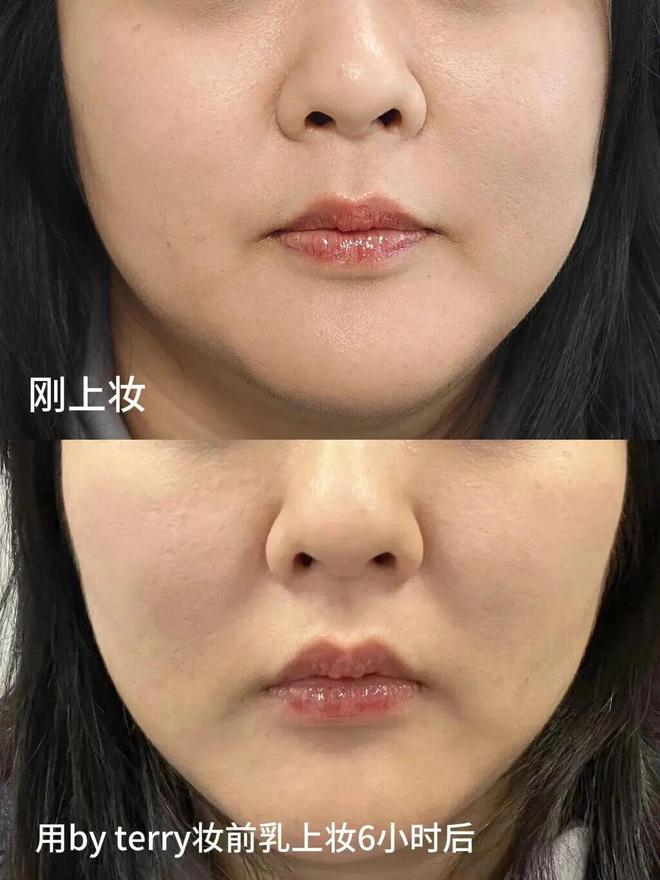 好气色用了一整年才来分享ag九游会登录线分钟搞定(图9)