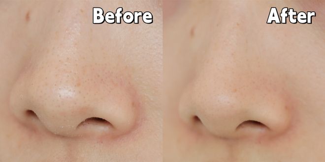 好气色用了一整年才来分享ag九游会登录线分钟搞定(图41)